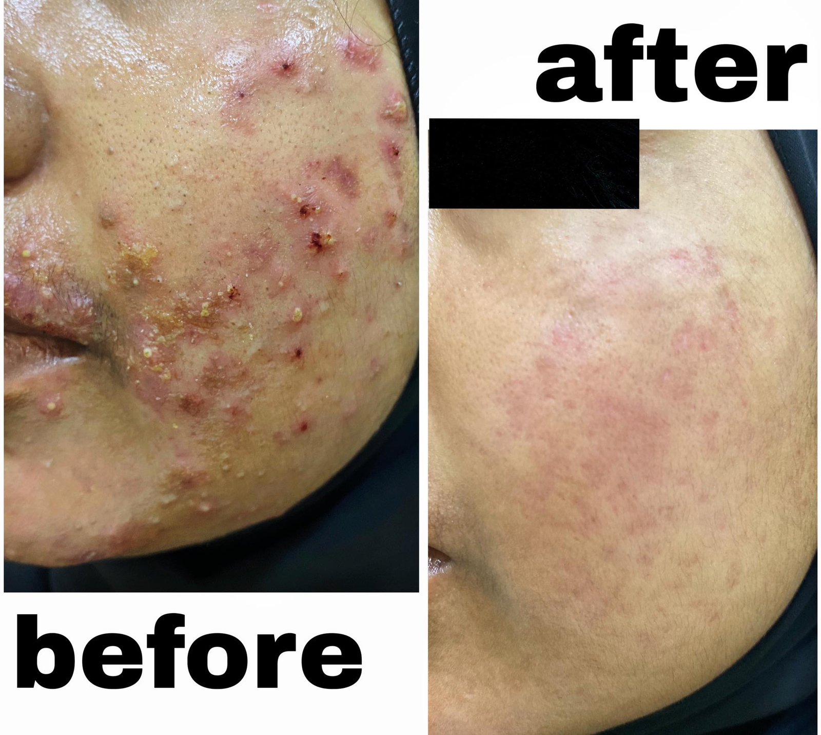 605619937_1319634096631223_1617718941245128084_n