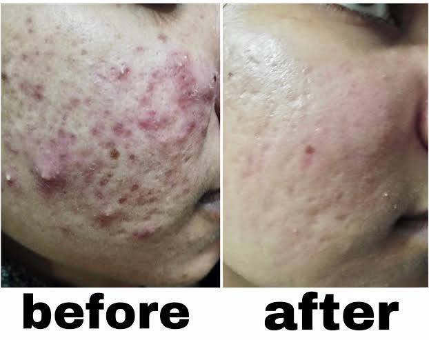 633383490_122097306027271607_3836390298957859757_n