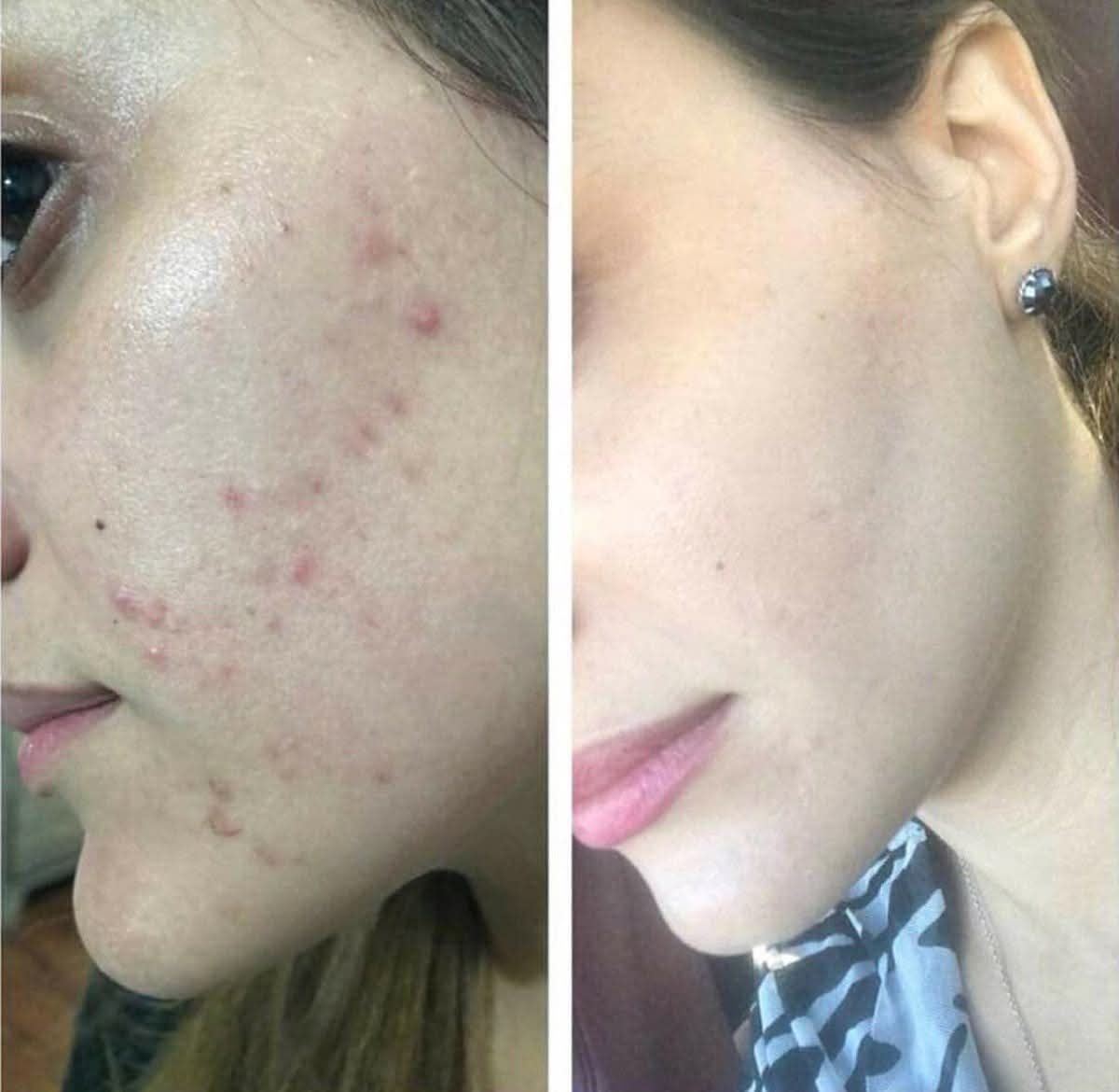 633551144_122097296049271607_6070327741810530625_n