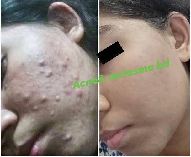 633866120_122097301407271607_8199413071270628561_n